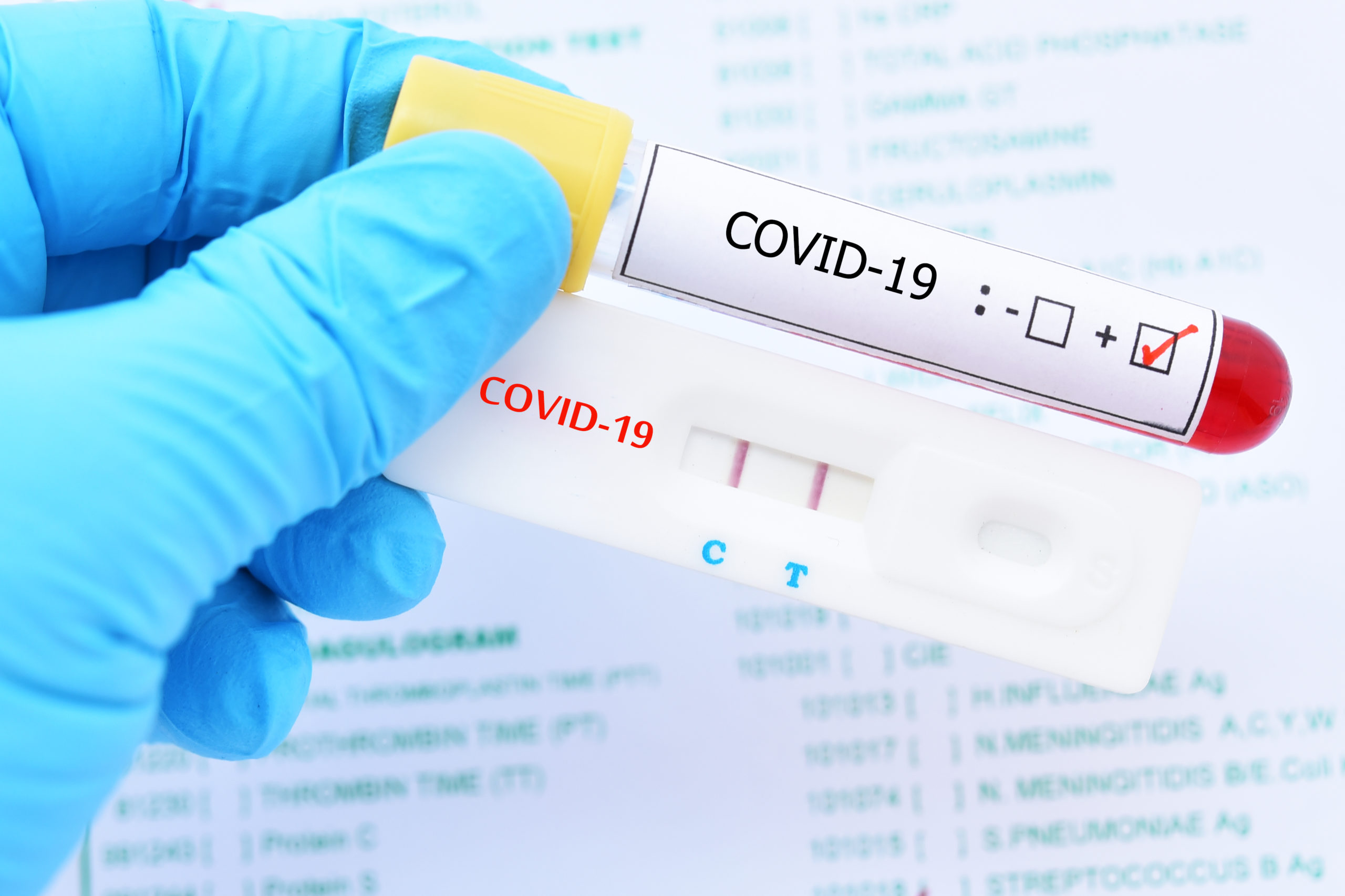 Read more about the article FAQs on rapid antigen tests