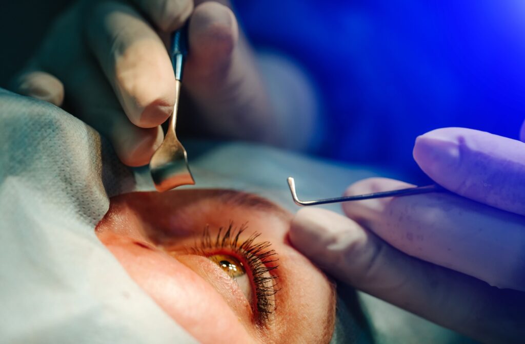 Understanding Cataract Eye Surgery: How It Restores Clear Vision