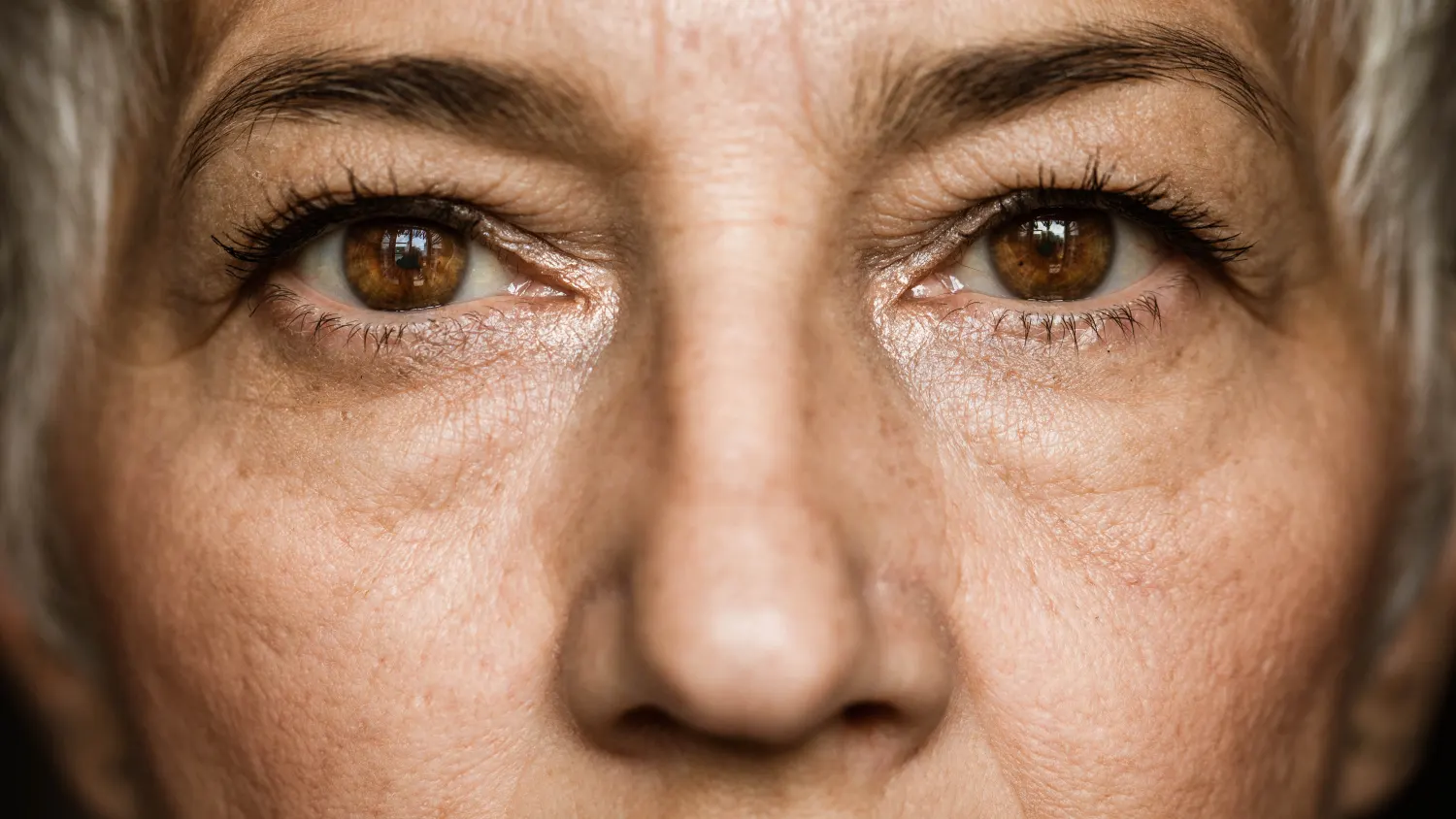 You are currently viewing Is Cataract Surgery Safe? Risks, Success Rates, and Recovery